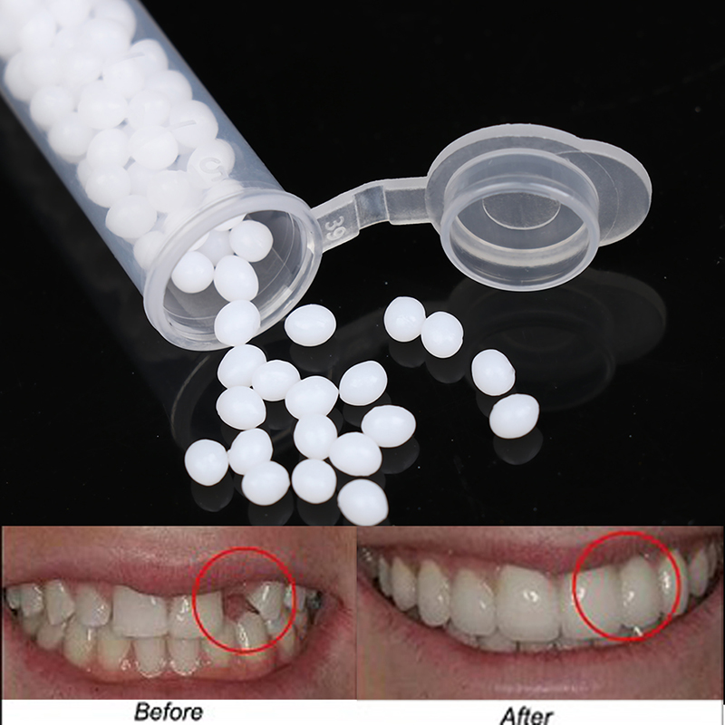 【K】1Box Temporary Tooth Repair - Teeth Whitening Kit recension och pris
